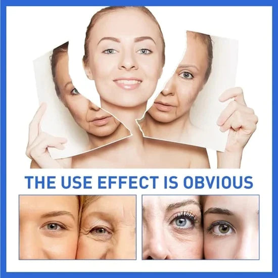 🎁Last Day Promotion 🎁-NESLEMY Salicylic Acid Extract