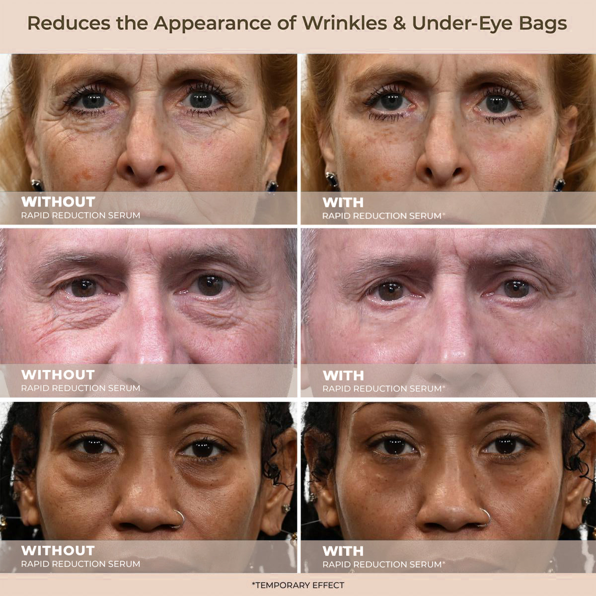 Insideefy™ Rapid Reduction Wrinkle Serum