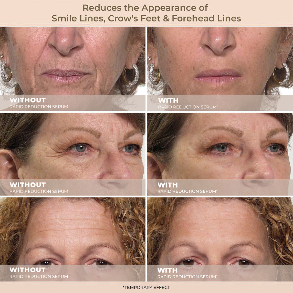Insideefy™ Rapid Reduction Wrinkle Serum