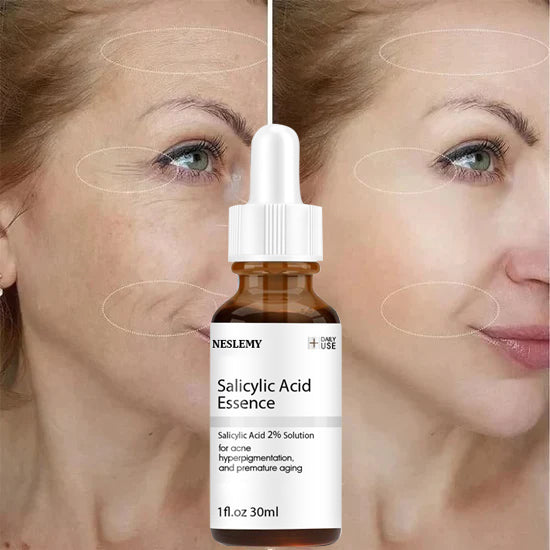 🎁Last Day Promotion 🎁-NESLEMY Salicylic Acid Extract