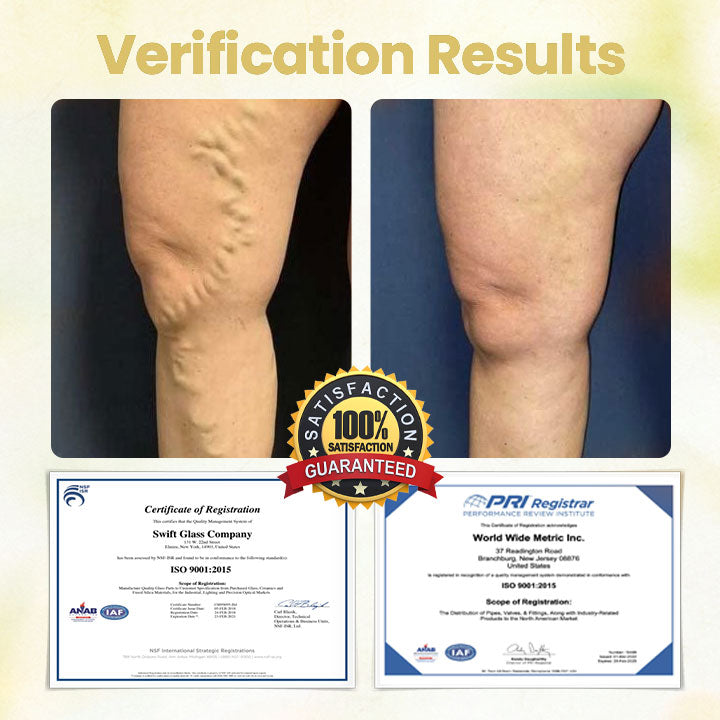 LOVILDS™ Lymphatic Detox Herbal Cream