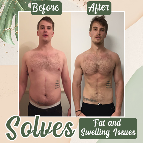 Histone Perfect Detox Slimming Patch(Limited Time Discount 🔥 Last Day)