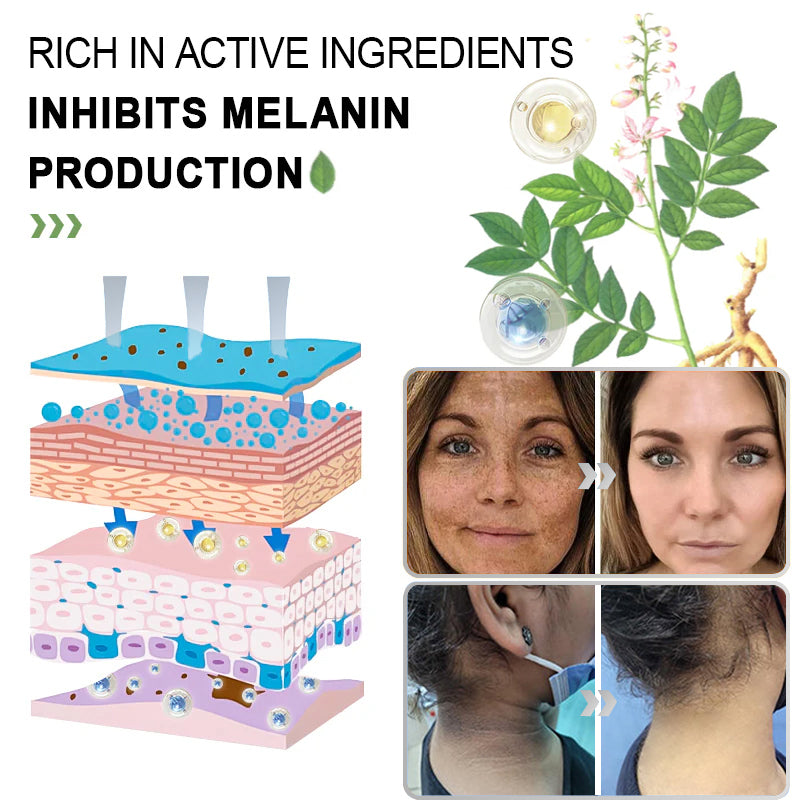 LOVILDS™ Radiance Cream for Acanthosis Nigricans, Exfoliation, Dark Spots