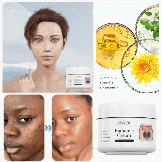 LOVILDS™ Radiance Cream for Acanthosis Nigricans, Exfoliation, Dark Spots
