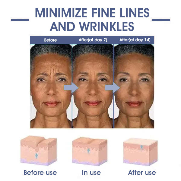 LOVILDS® 𝐀𝐝𝐯𝐚𝐧𝐜𝐞𝐝 𝐅𝐢𝐫𝐦𝐢𝐧𝐠 & 𝐖𝐫𝐢𝐧𝐤𝐥𝐞-𝐑𝐞𝐝𝐮𝐜𝐢𝐧𝐠 𝐂𝐫𝐞𝐚𝐦: Restore Skin Elasticity⭐