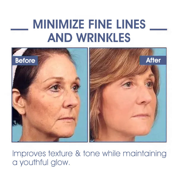 LOVILDS® 𝐀𝐝𝐯𝐚𝐧𝐜𝐞𝐝 𝐅𝐢𝐫𝐦𝐢𝐧𝐠 & 𝐖𝐫𝐢𝐧𝐤𝐥𝐞-𝐑𝐞𝐝𝐮𝐜𝐢𝐧𝐠 𝐂𝐫𝐞𝐚𝐦: Restore Skin Elasticity⭐