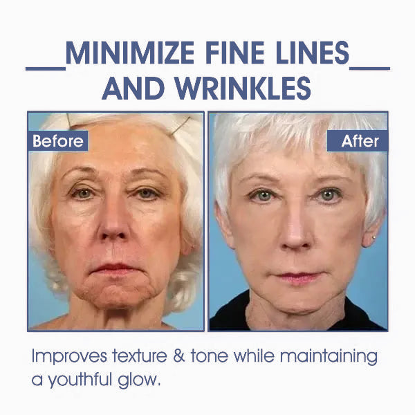 LOVILDS® 𝐀𝐝𝐯𝐚𝐧𝐜𝐞𝐝 𝐅𝐢𝐫𝐦𝐢𝐧𝐠 & 𝐖𝐫𝐢𝐧𝐤𝐥𝐞-𝐑𝐞𝐝𝐮𝐜𝐢𝐧𝐠 𝐂𝐫𝐞𝐚𝐦: Restore Skin Elasticity⭐