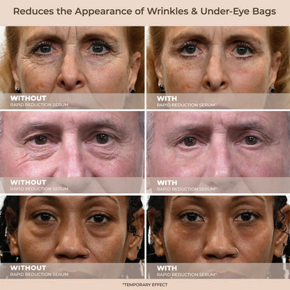 Insideefy™ Rapid Reduction Wrinkle Serum