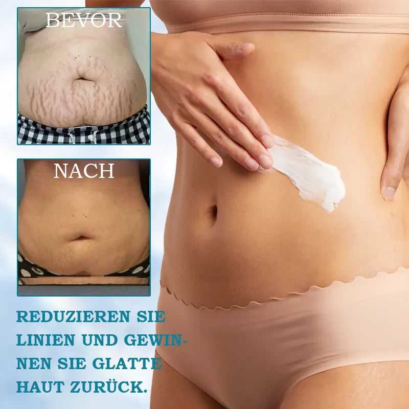 LOVILDS® 𝐀𝐝𝐯𝐚𝐧𝐜𝐞𝐝 𝐅𝐢𝐫𝐦𝐢𝐧𝐠 & 𝐖𝐫𝐢𝐧𝐤𝐥𝐞-𝐑𝐞𝐝𝐮𝐜𝐢𝐧𝐠 𝐂𝐫𝐞𝐚𝐦: Restore Skin Elasticity⭐