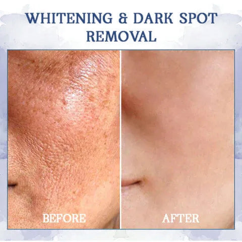 LOVILDS® 𝐀𝐝𝐯𝐚𝐧𝐜𝐞𝐝 𝐅𝐢𝐫𝐦𝐢𝐧𝐠 & 𝐖𝐫𝐢𝐧𝐤𝐥𝐞-𝐑𝐞𝐝𝐮𝐜𝐢𝐧𝐠 𝐂𝐫𝐞𝐚𝐦: Restore Skin Elasticity⭐