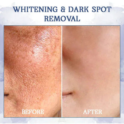 LOVILDS® 𝐀𝐝𝐯𝐚𝐧𝐜𝐞𝐝 𝐅𝐢𝐫𝐦𝐢𝐧𝐠 & 𝐖𝐫𝐢𝐧𝐤𝐥𝐞-𝐑𝐞𝐝𝐮𝐜𝐢𝐧𝐠 𝐂𝐫𝐞𝐚𝐦: Restore Skin Elasticity⭐
