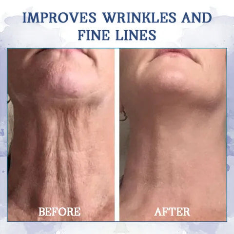LOVILDS® 𝐀𝐝𝐯𝐚𝐧𝐜𝐞𝐝 𝐅𝐢𝐫𝐦𝐢𝐧𝐠 & 𝐖𝐫𝐢𝐧𝐤𝐥𝐞-𝐑𝐞𝐝𝐮𝐜𝐢𝐧𝐠 𝐂𝐫𝐞𝐚𝐦: Restore Skin Elasticity⭐
