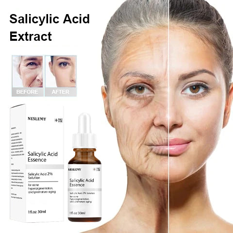 🎁Last Day Promotion 🎁-NESLEMY Salicylic Acid Extract