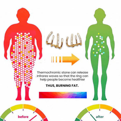 Histone Acupressure Slimming Earrings（Limited Time Discount 🔥 Last Day）