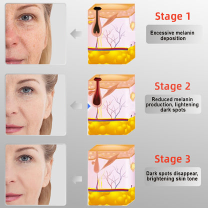 LOVILDS™ Radiance Cream for Acanthosis Nigricans, Exfoliation, Dark Spots